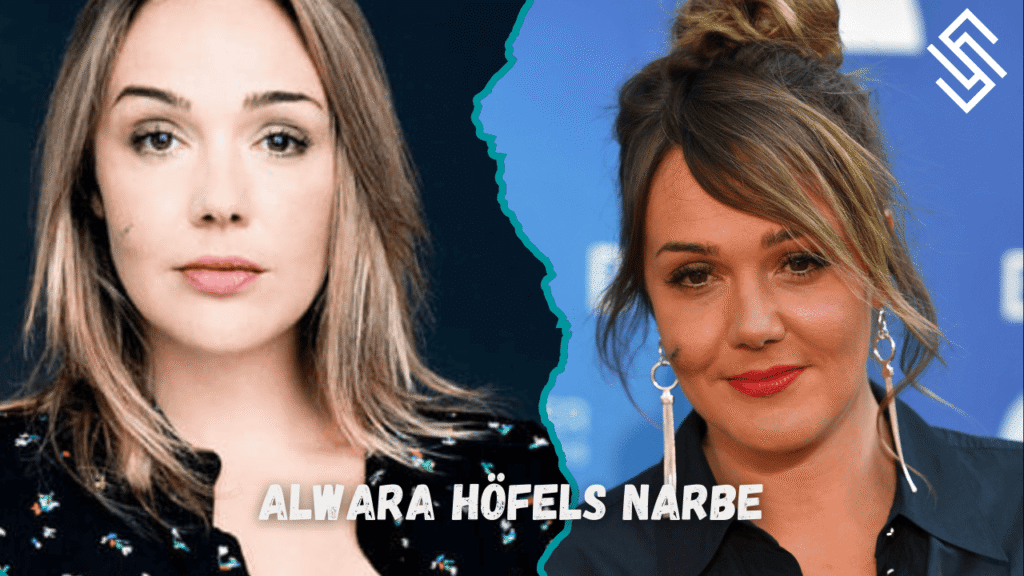 Alwara Höfels Narbe — schnelle Tipps & klare Lösungen für sichtbare Narben